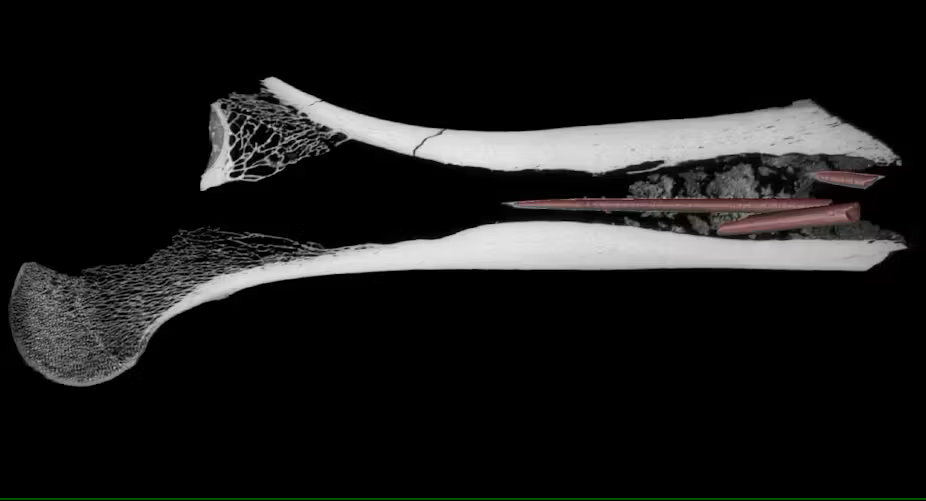CT-scan thin section through the centre of the bovid femur. The three bone arrowhead fragments and poison substance are visible. CT rendering and image segmentation: Dr Aliénor Duhamel, CC BY-NC-ND